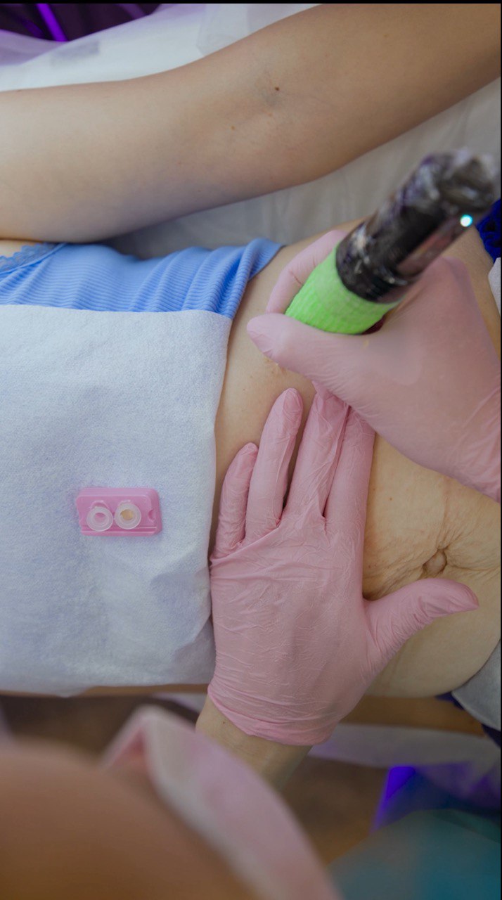 Blog. Cosmetic and Medical Tattoo by Dasha. Permanent makeup and reconstructive tattoo, scalp micro-pigmentation in Christchurch, New Zealand