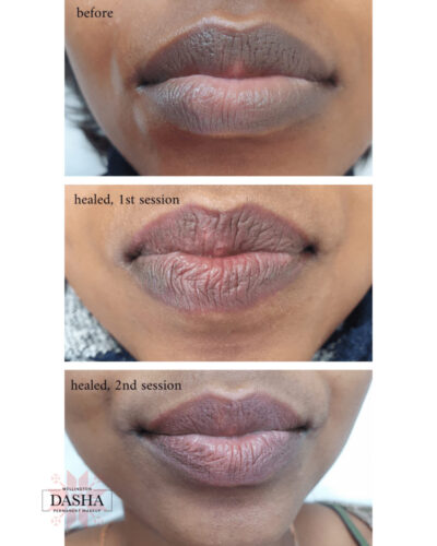 Consultation Lip Blush Tattoo. Cosmetic and Mediical Tattoo by Dasha. Permanent makeup and reconstructive tattoo, scalp micro-pigmentation in Christchurch, New Zealand