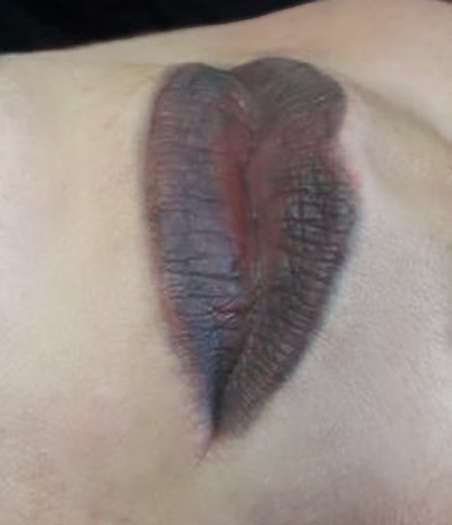 Touch-up for a tattoo that`s been done by someone else. Cosmetic and Mediical Tattoo by Dasha. Permanent makeup and reconstructive tattoo, scalp micro-pigmentation in Christchurch, New Zealand
