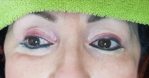 Touch-up for a tattoo that`s been done by someone else. Cosmetic and Mediical Tattoo by Dasha. Permanent makeup and reconstructive tattoo, scalp micro-pigmentation in Christchurch, New Zealand