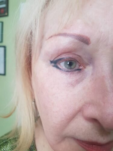 Touch-up for a tattoo that`s been done by someone else. Cosmetic and Mediical Tattoo by Dasha. Permanent makeup and reconstructive tattoo, scalp micro-pigmentation in Christchurch, New Zealand