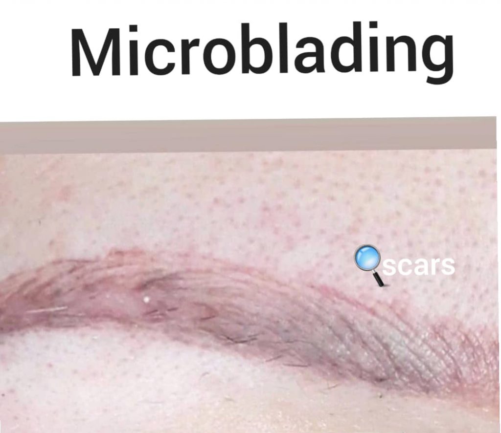 About Microblading. Cosmetic and Mediical Tattoo by Dasha. Permanent makeup and reconstructive tattoo, scalp micro-pigmentation in Christchurch, New Zealand