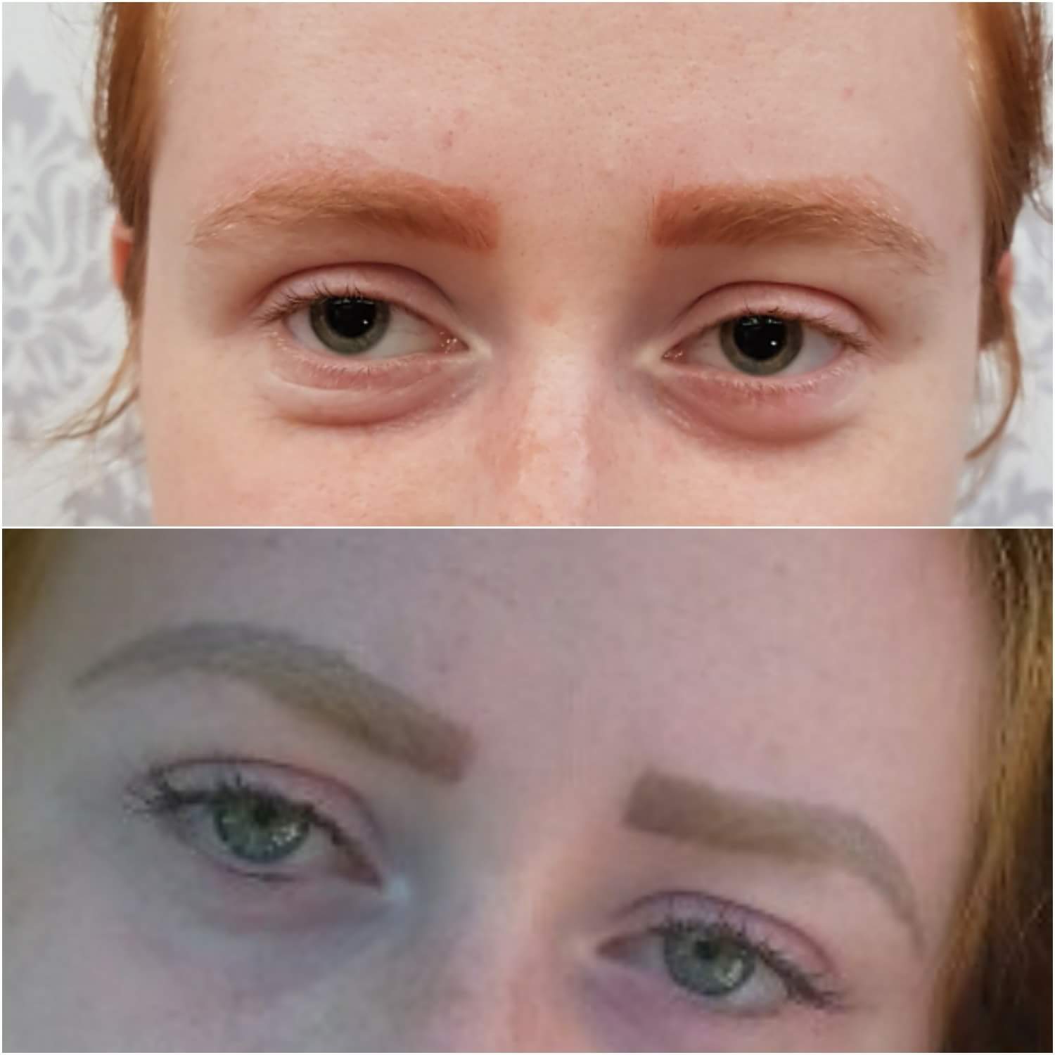 Laser & Non-laser Methods for Brows Tattoo Removal. Cosmetic and Mediical Tattoo by Dasha. Permanent makeup and reconstructive tattoo, scalp micro-pigmentation in Christchurch, New Zealand