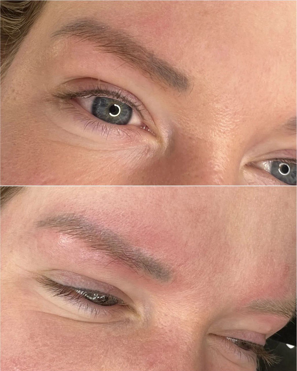 Nd:Yag Laser Tattoo Removal. Cosmetic and Mediical Tattoo by Dasha. Permanent makeup and reconstructive tattoo, scalp micro-pigmentation in Christchurch, New Zealand
