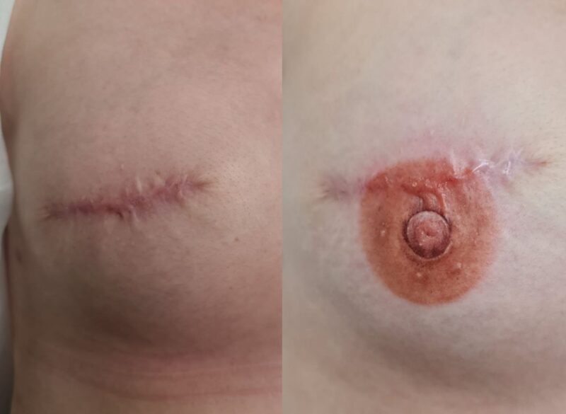 AReola Pigments by Alla Romazanova 15ml. Cosmetic and Mediical Tattoo by Dasha. Permanent makeup and reconstructive tattoo, scalp micro-pigmentation in Christchurch, New Zealand