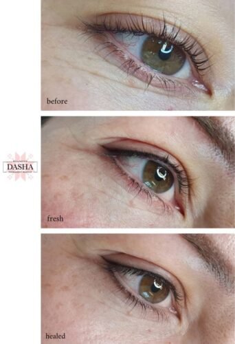Consultation Eyeliner Cosmetic Tattoo. Cosmetic and Mediical Tattoo by Dasha. Permanent makeup and reconstructive tattoo, scalp micro-pigmentation in Christchurch, New Zealand