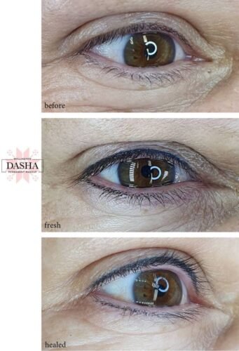 Consultation Eyeliner Cosmetic Tattoo. Cosmetic and Mediical Tattoo by Dasha. Permanent makeup and reconstructive tattoo, scalp micro-pigmentation in Christchurch, New Zealand