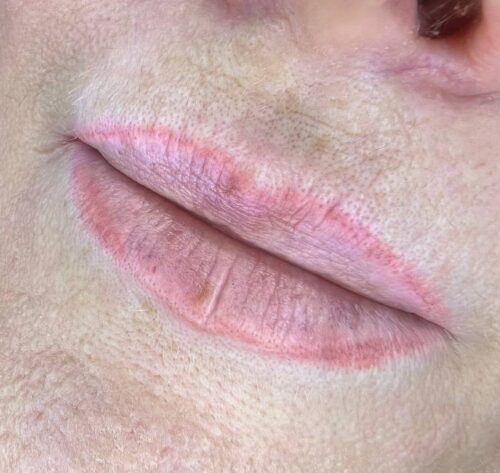 Consultation Lip Blush Tattoo. Cosmetic and Mediical Tattoo by Dasha. Permanent makeup and reconstructive tattoo, scalp micro-pigmentation in Christchurch, New Zealand