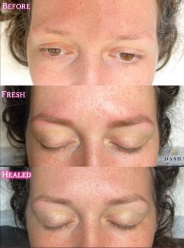 Consultation Eyebrows Cosmetic Tattoo. Cosmetic and Mediical Tattoo by Dasha. Permanent makeup and reconstructive tattoo, scalp micro-pigmentation in Christchurch, New Zealand