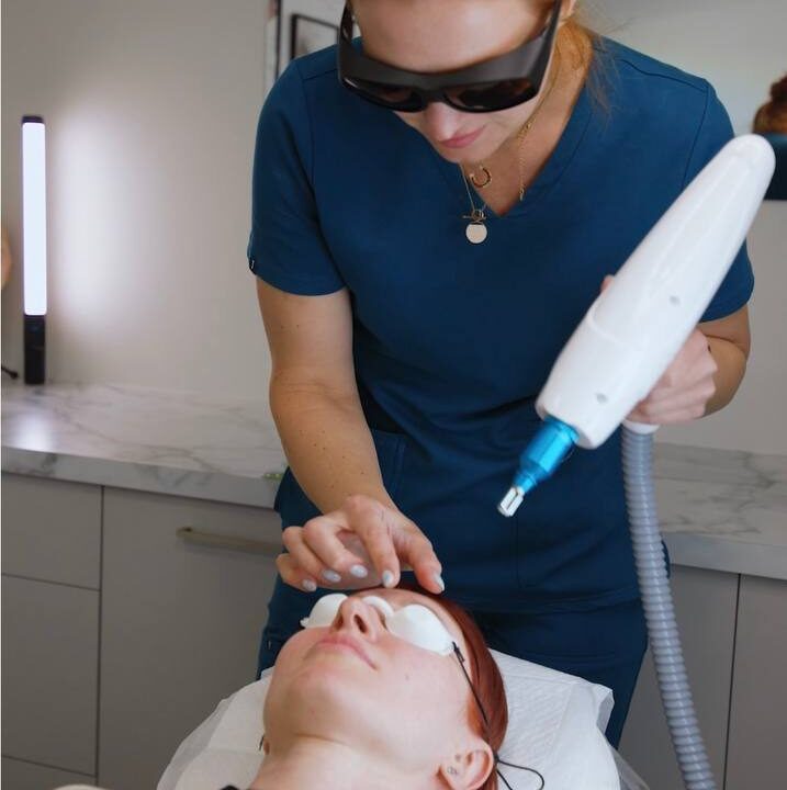 Eyebrow Laser Tattoo Removal. Cosmetic and Mediical Tattoo by Dasha. Permanent makeup and reconstructive tattoo, scalp micro-pigmentation in Christchurch, New Zealand