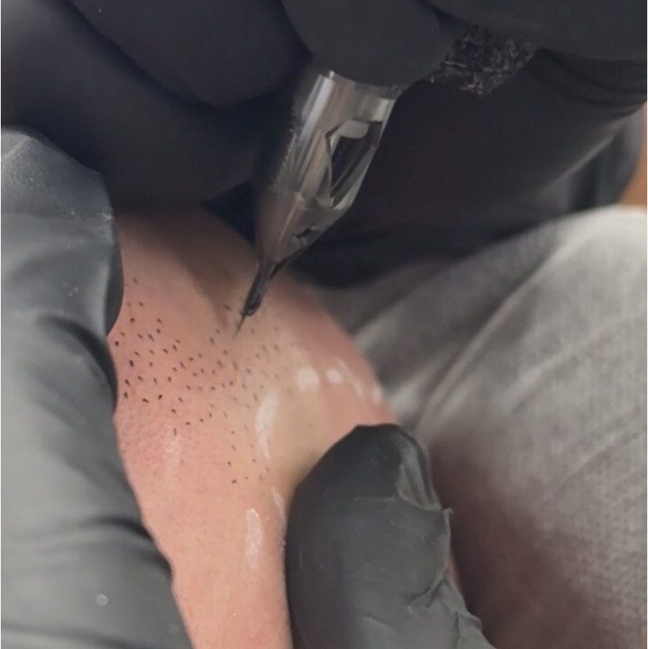 Scalp Micropigmentation FAQ. Cosmetic and Mediical Tattoo by Dasha. Permanent makeup and reconstructive tattoo, scalp micro-pigmentation in Christchurch, New Zealand