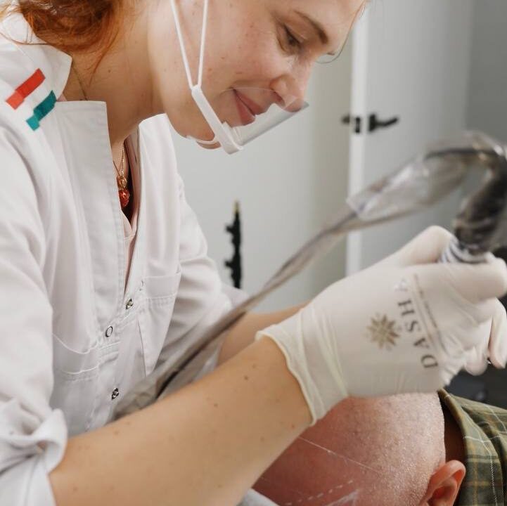 Scalp Micropigmentation. Preparation & aftercare guide.. Cosmetic and Mediical Tattoo by Dasha. Permanent makeup and reconstructive tattoo, scalp micro-pigmentation in Christchurch, New Zealand