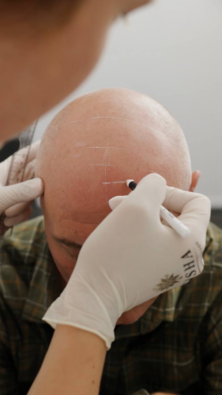 Blog. Cosmetic and Medical Tattoo by Dasha. Permanent makeup and reconstructive tattoo, scalp micro-pigmentation in Christchurch, New Zealand