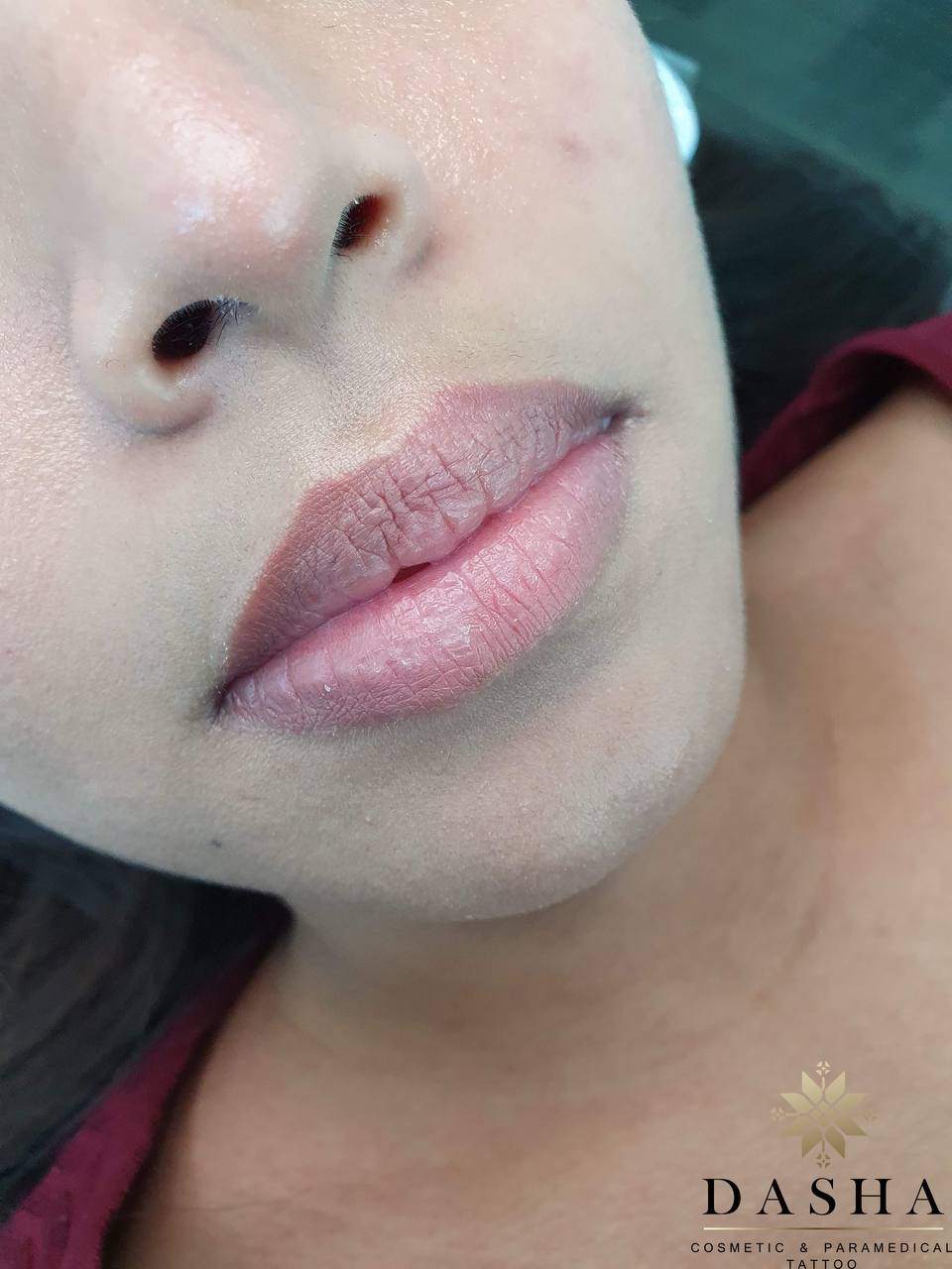 Dark Lip Neutralization Cosmetic Tattoo. Cosmetic and Mediical Tattoo by Dasha. Permanent makeup and reconstructive tattoo, scalp micro-pigmentation in Christchurch, New Zealand