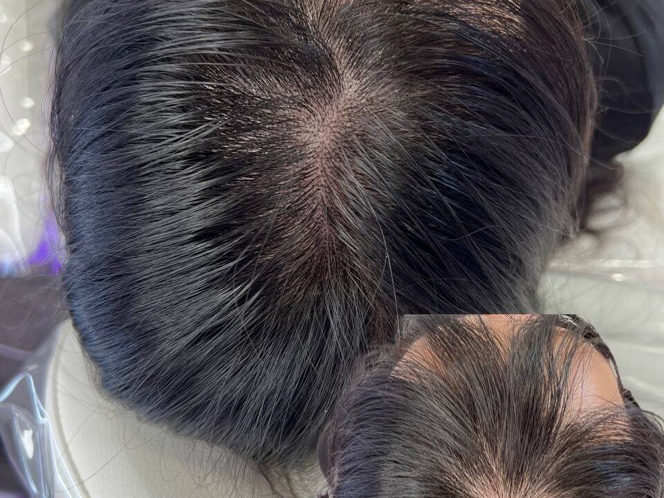 Femail Scalp Micropigmentation. Cosmetic and Mediical Tattoo by Dasha. Permanent makeup and reconstructive tattoo, scalp micro-pigmentation in Christchurch, New Zealand