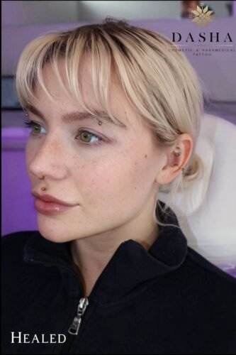 Freckles or a Beauty Mark Cosmetic Tattoo. Cosmetic and Mediical Tattoo by Dasha. Permanent makeup and reconstructive tattoo, scalp micro-pigmentation in Christchurch, New Zealand