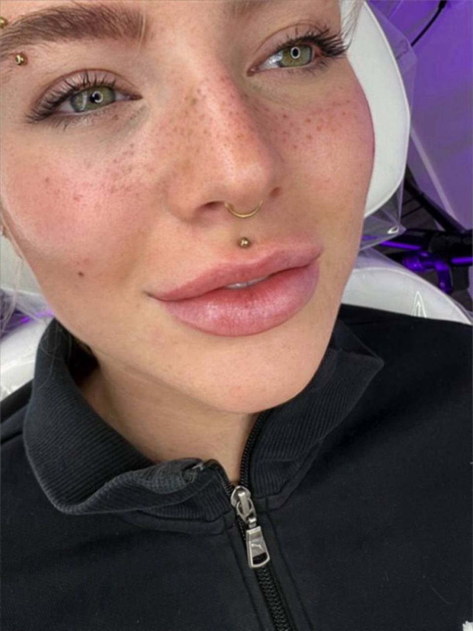 Lip Outline Cosmetic Tattoo. Cosmetic and Mediical Tattoo by Dasha. Permanent makeup and reconstructive tattoo, scalp micro-pigmentation in Christchurch, New Zealand