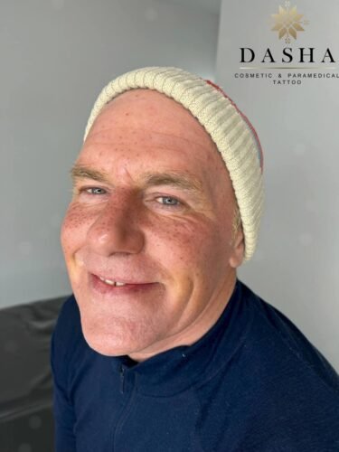 Freckles or a Beauty Mark Cosmetic Tattoo. Cosmetic and Mediical Tattoo by Dasha. Permanent makeup and reconstructive tattoo, scalp micro-pigmentation in Christchurch, New Zealand