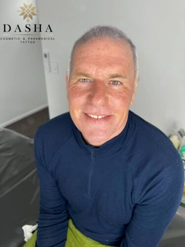 Freckles or a Beauty Mark Cosmetic Tattoo. Cosmetic and Mediical Tattoo by Dasha. Permanent makeup and reconstructive tattoo, scalp micro-pigmentation in Christchurch, New Zealand