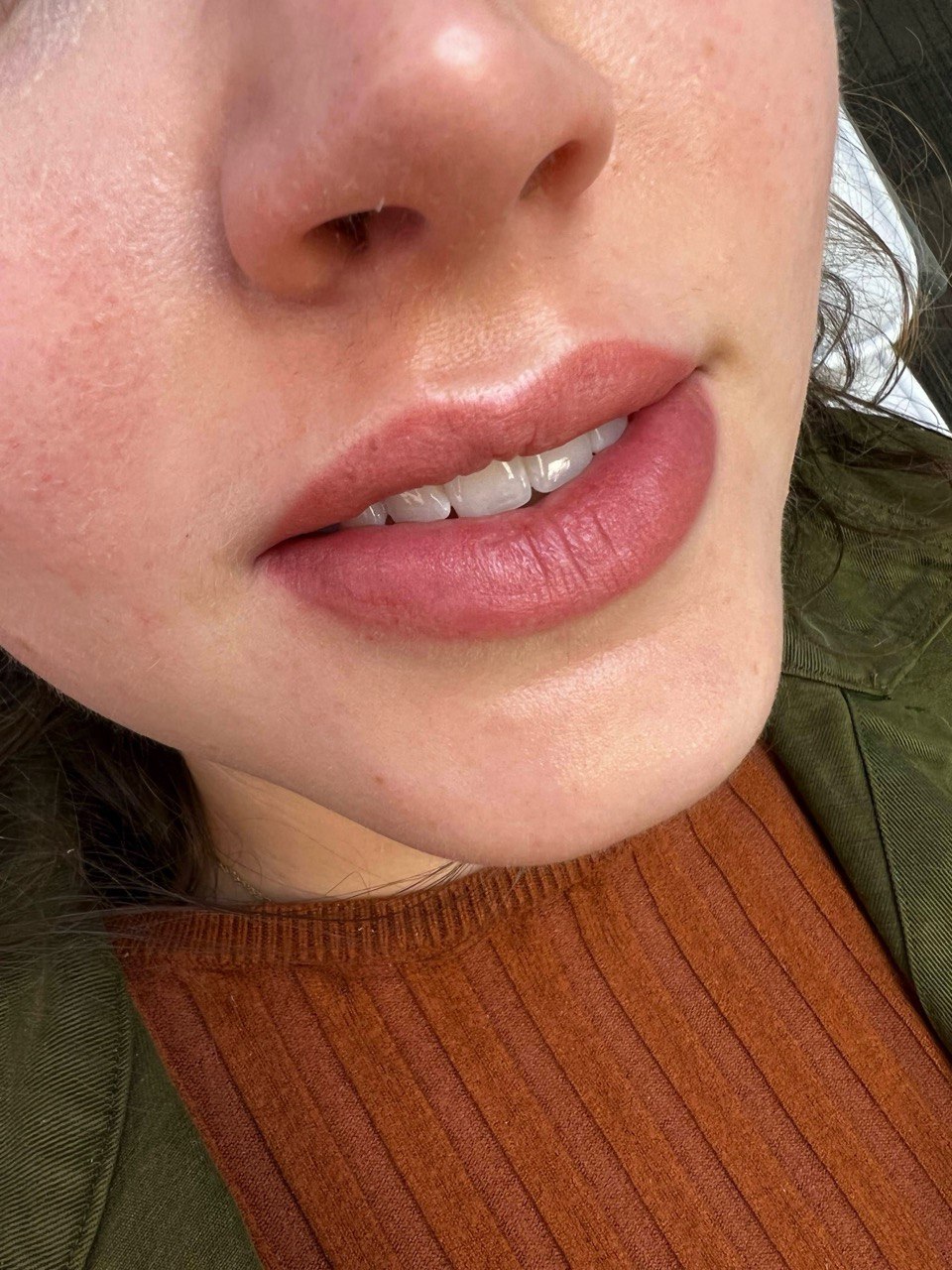 Lip Blush Tattoo. Cosmetic and Mediical Tattoo by Dasha. Permanent makeup and reconstructive tattoo, scalp micro-pigmentation in Christchurch, New Zealand