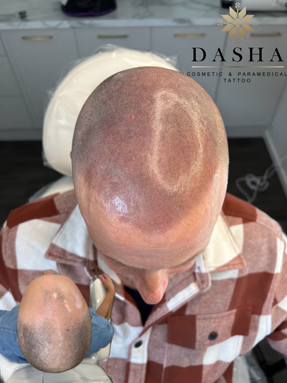 SMP Scalp MIcropigmentation Dasha Cosmetic Tattoo Christchurch New Zealand