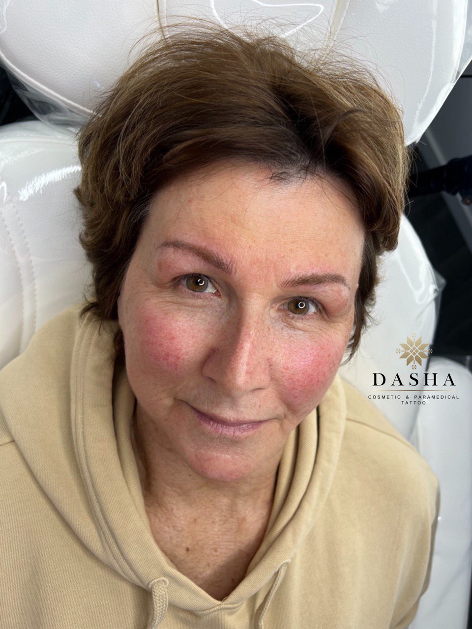 Combination (machine hairstrokes + shading). Cosmetic and Mediical Tattoo by Dasha. Permanent makeup and reconstructive tattoo, scalp micro-pigmentation in Christchurch, New Zealand