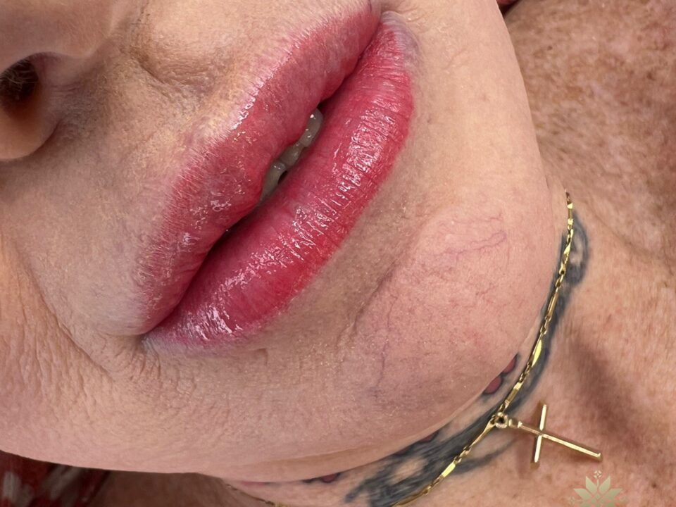 Lip Blush Tattoo. Cosmetic and Mediical Tattoo by Dasha. Permanent makeup and reconstructive tattoo, scalp micro-pigmentation in Christchurch, New Zealand