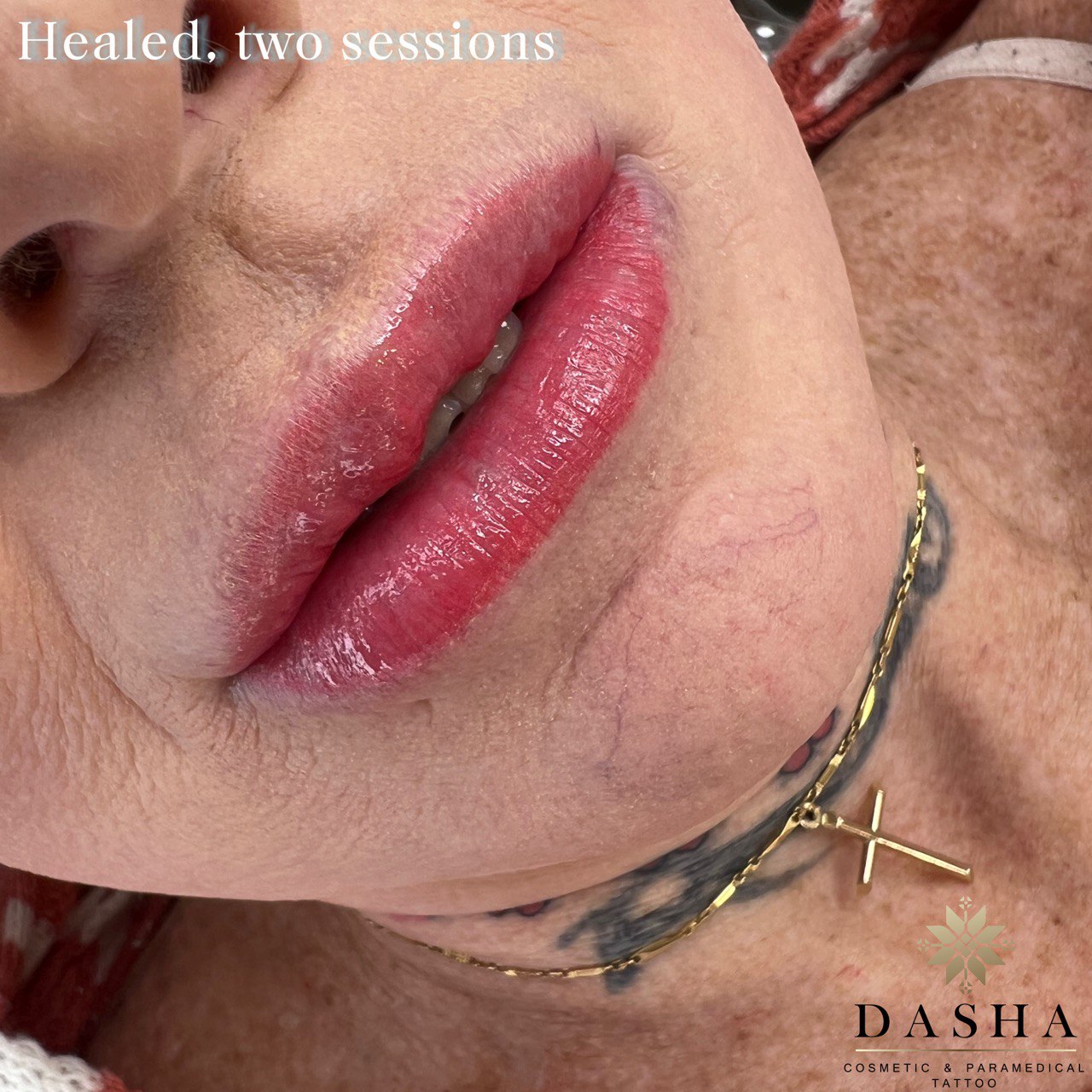 Lip Blush Tattoo. Cosmetic and Mediical Tattoo by Dasha. Permanent makeup and reconstructive tattoo, scalp micro-pigmentation in Christchurch, New Zealand