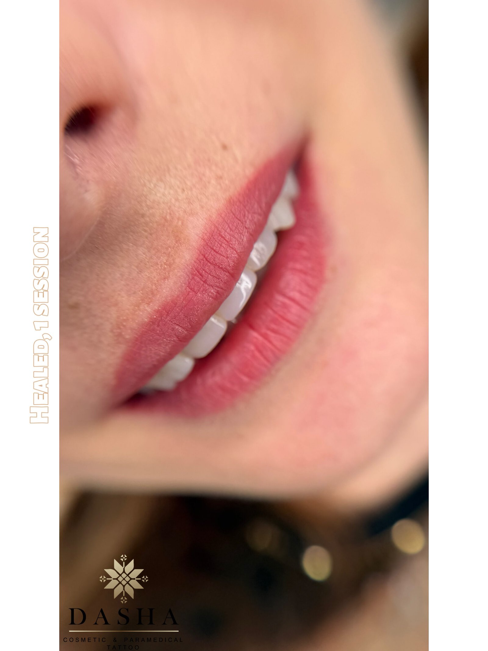 Lip Blush Cosmetic Tattoo