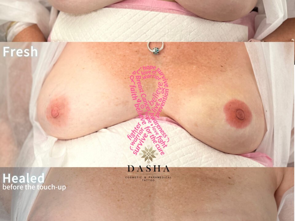 3D Nipple Tattoo. Cosmetic and Mediical Tattoo by Dasha. Permanent makeup and reconstructive tattoo, scalp micro-pigmentation in Christchurch, New Zealand