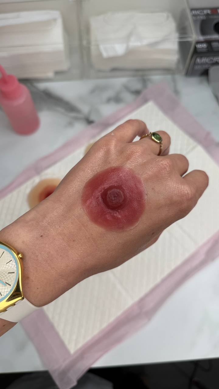 Custom Silicone Nipple & Areola Prosthetics. Cosmetic and Mediical Tattoo by Dasha. Permanent makeup and reconstructive tattoo, scalp micro-pigmentation in Christchurch, New Zealand