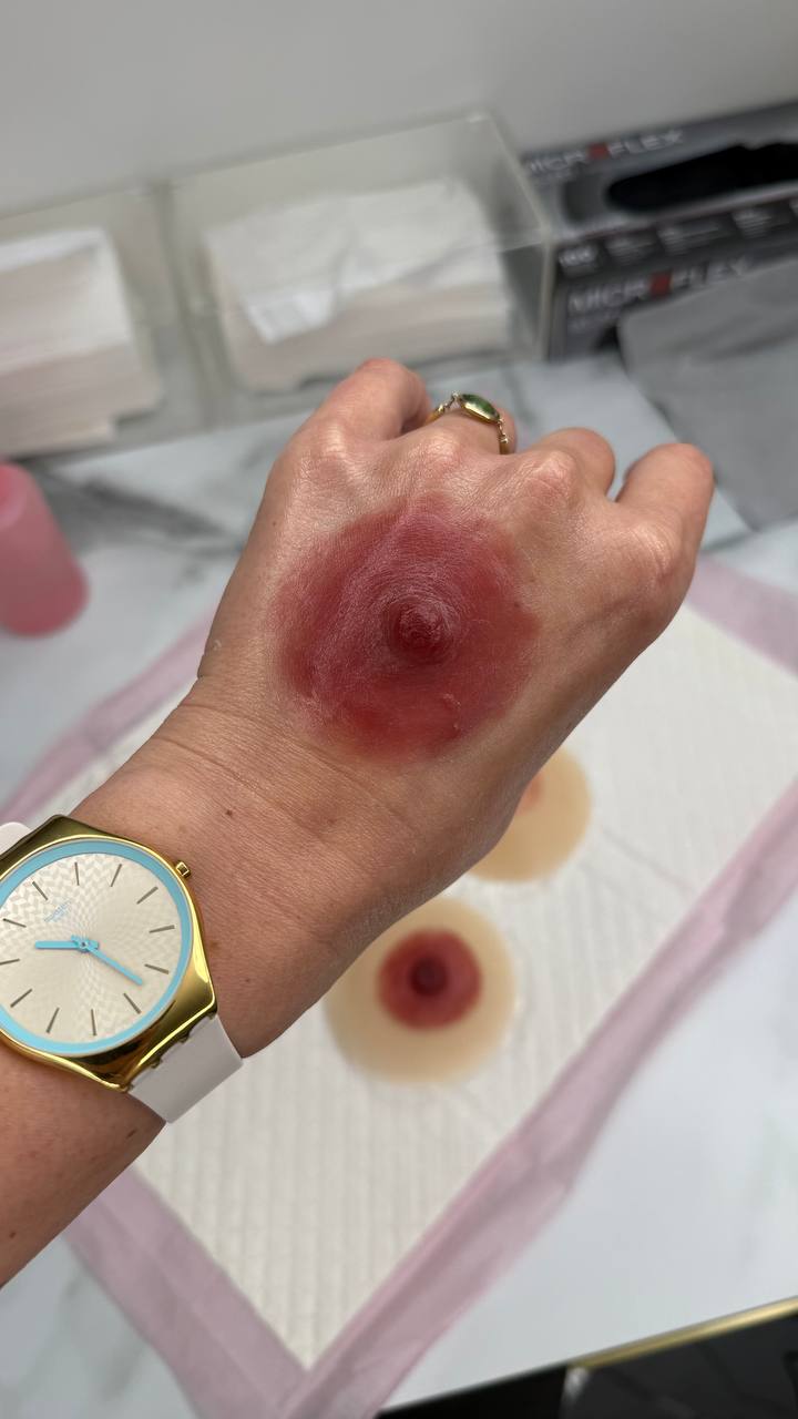 Custom Silicone Nipple & Areola Prosthetics. Cosmetic and Mediical Tattoo by Dasha. Permanent makeup and reconstructive tattoo, scalp micro-pigmentation in Christchurch, New Zealand