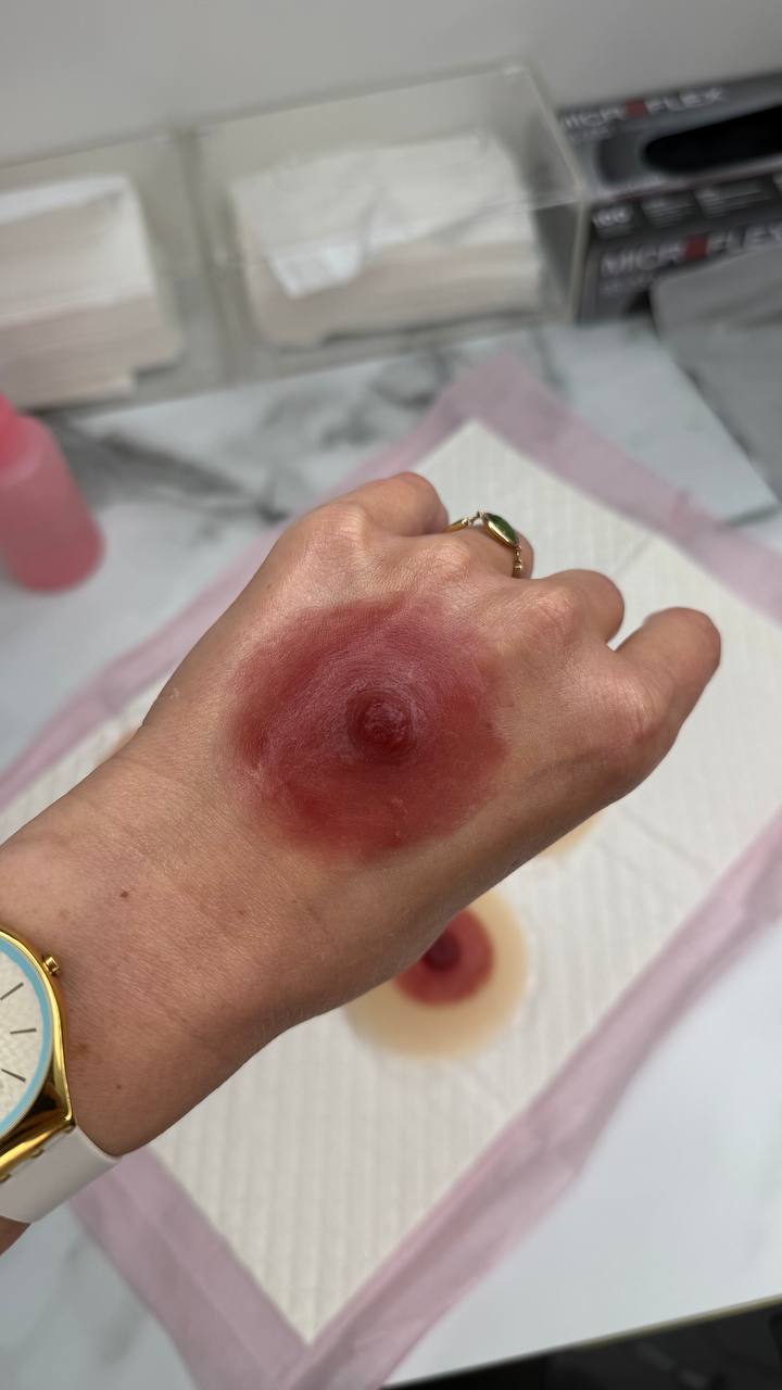 Custom Made Silicone Nipple & Areola Prosthetics. Cosmetic and Mediical Tattoo by Dasha. Permanent makeup and reconstructive tattoo, scalp micro-pigmentation in Christchurch, New Zealand