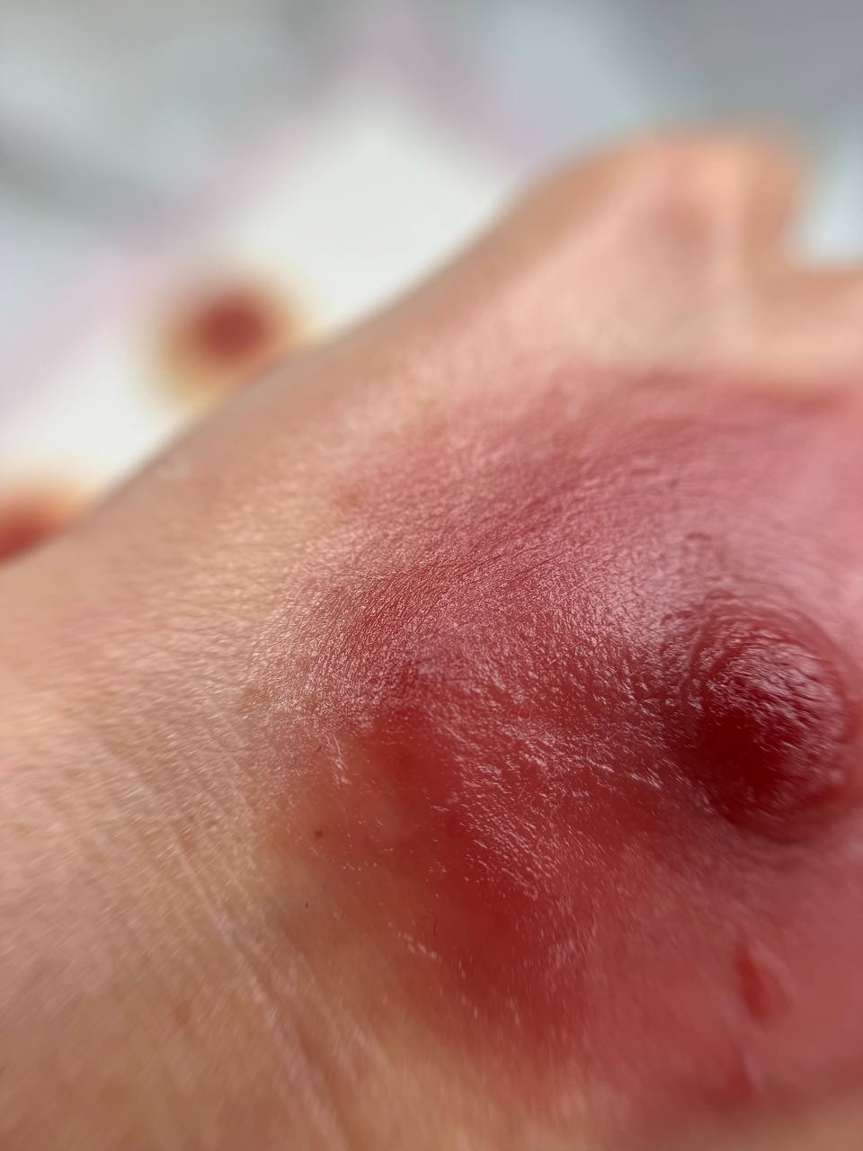 Custom Silicone Nipple & Areola Prosthetics. Cosmetic and Mediical Tattoo by Dasha. Permanent makeup and reconstructive tattoo, scalp micro-pigmentation in Christchurch, New Zealand