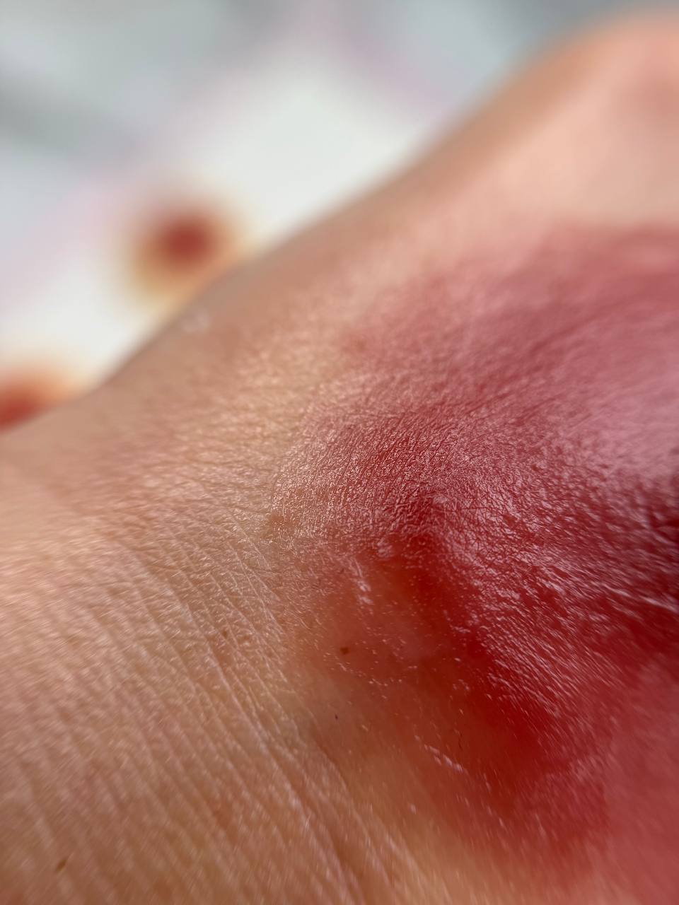 Custom Silicone Nipple & Areola Prosthetics. Cosmetic and Mediical Tattoo by Dasha. Permanent makeup and reconstructive tattoo, scalp micro-pigmentation in Christchurch, New Zealand