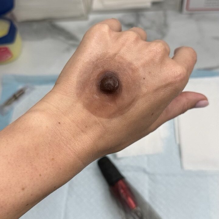 Custom Silicone Nipple & Areola Prosthetics. Cosmetic and Mediical Tattoo by Dasha. Permanent makeup and reconstructive tattoo, scalp micro-pigmentation in Christchurch, New Zealand