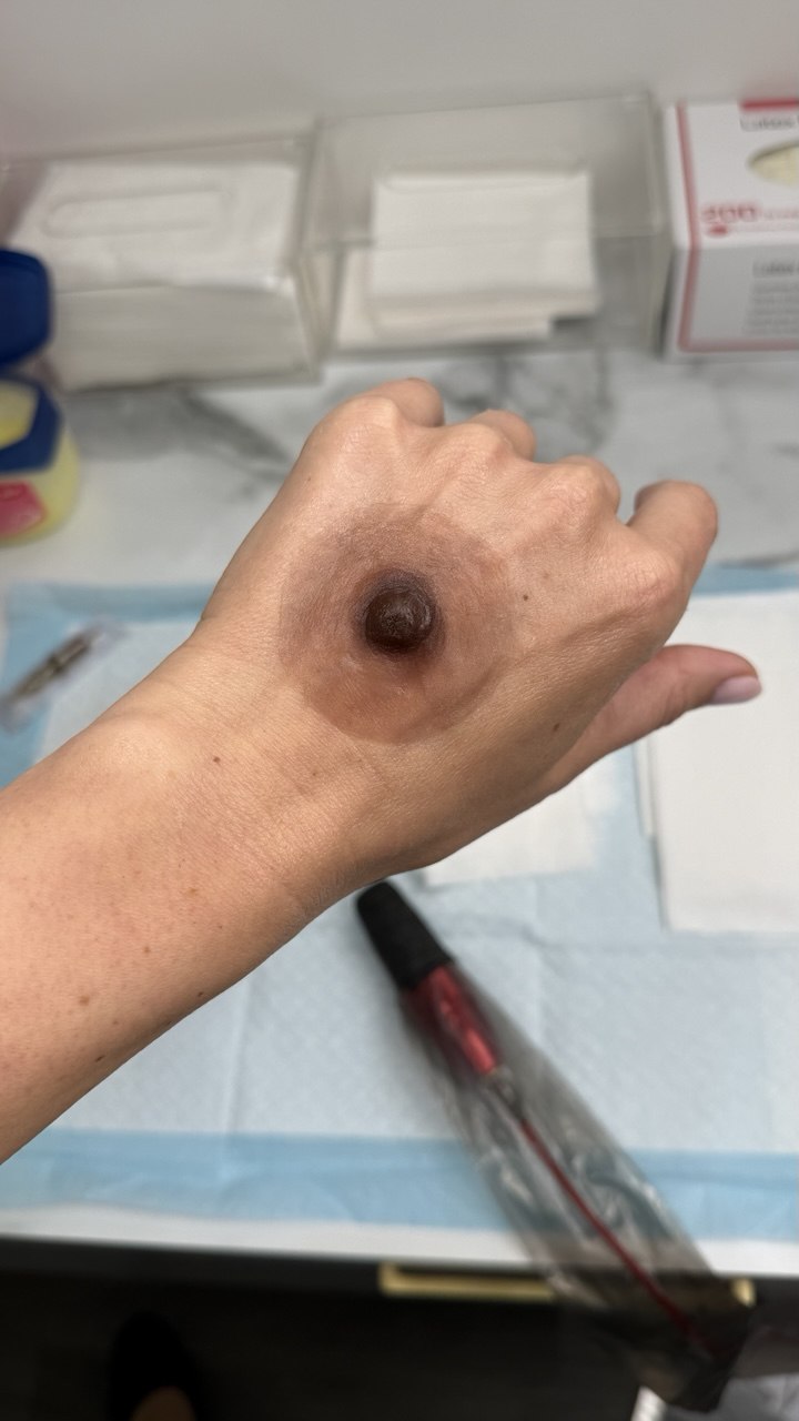 Custom Silicone Nipple & Areola Prosthetics. Cosmetic and Mediical Tattoo by Dasha. Permanent makeup and reconstructive tattoo, scalp micro-pigmentation in Christchurch, New Zealand