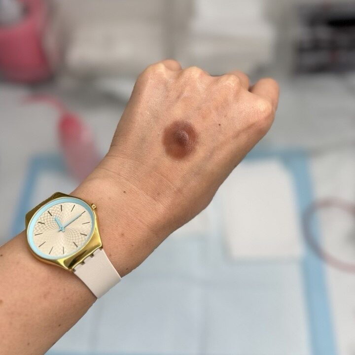 Custom Silicone Nipple & Areola Prosthetics. Cosmetic and Mediical Tattoo by Dasha. Permanent makeup and reconstructive tattoo, scalp micro-pigmentation in Christchurch, New Zealand