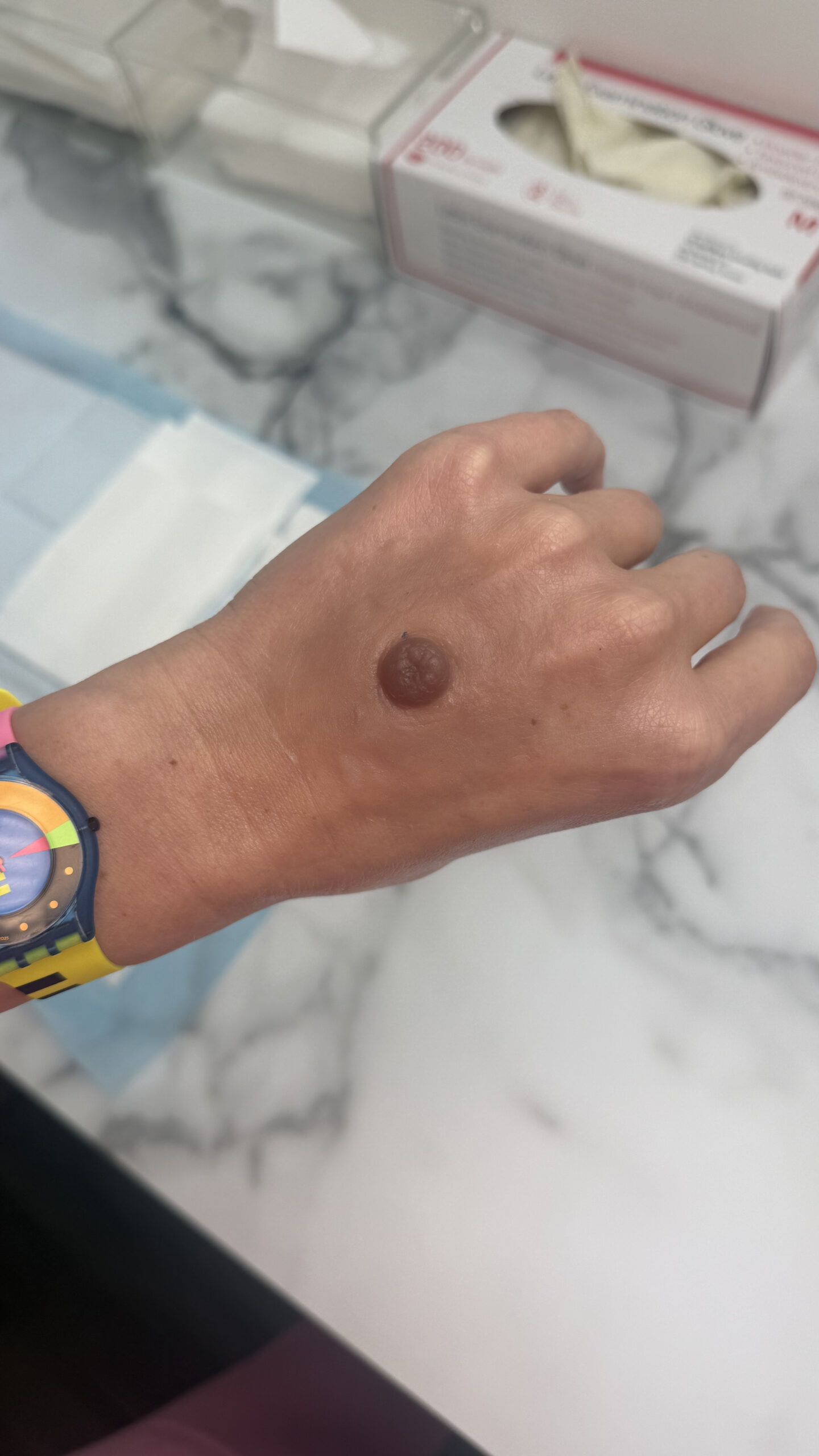 Custom Made Silicone Nipple & Areola Prosthetics. Cosmetic and Mediical Tattoo by Dasha. Permanent makeup and reconstructive tattoo, scalp micro-pigmentation in Christchurch, New Zealand