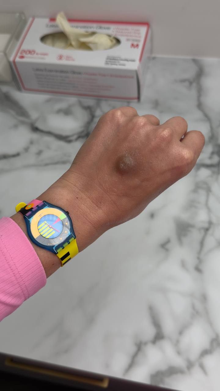 Custom Made Nipple & Areola Prosthetics. Cosmetic and Mediical Tattoo by Dasha. Permanent makeup and reconstructive tattoo, scalp micro-pigmentation in Christchurch, New Zealand