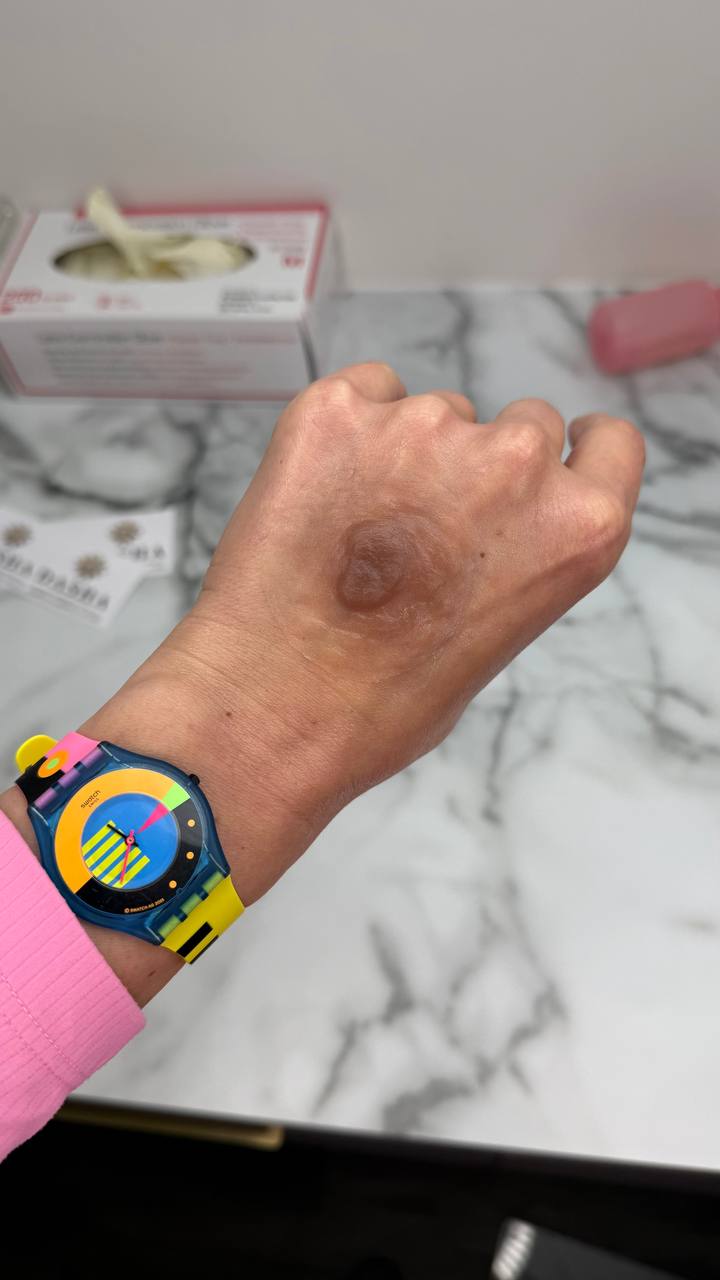 Custom Made Silicone Nipple & Areola Prosthetics. Cosmetic and Mediical Tattoo by Dasha. Permanent makeup and reconstructive tattoo, scalp micro-pigmentation in Christchurch, New Zealand