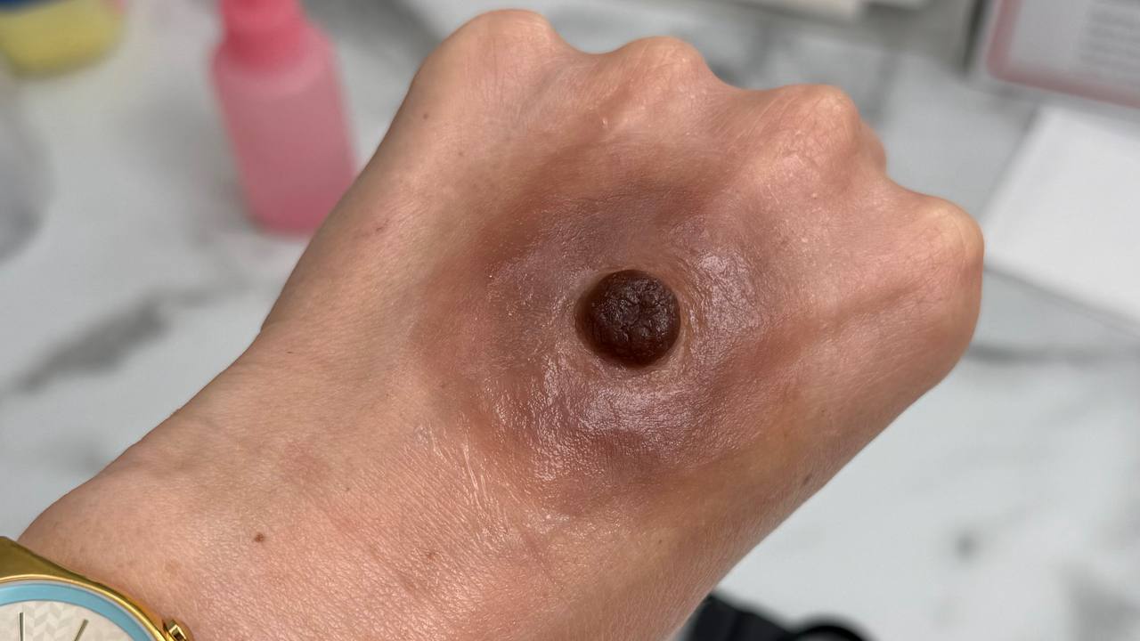 Custom Made Silicone Nipple & Areola Prosthetics. Cosmetic and Mediical Tattoo by Dasha. Permanent makeup and reconstructive tattoo, scalp micro-pigmentation in Christchurch, New Zealand