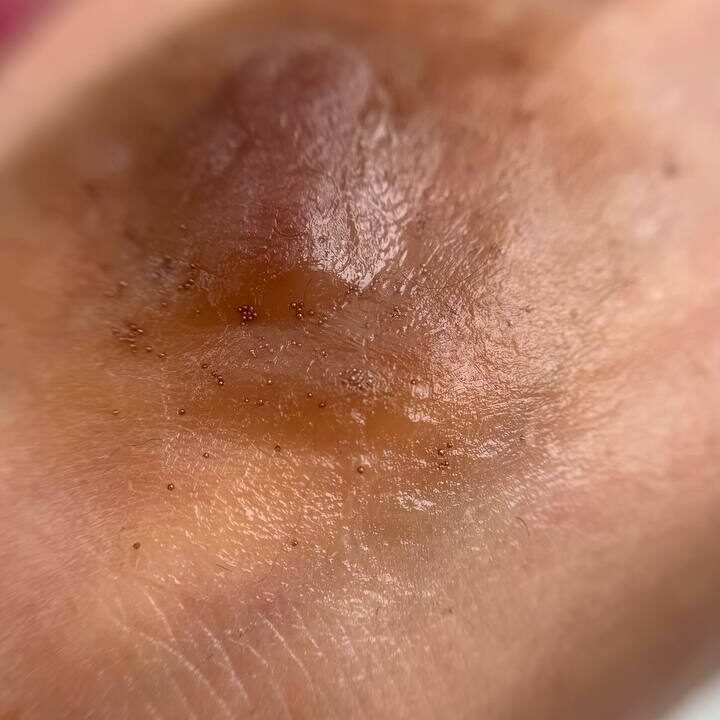 Custom Made Nipple & Areola Prosthetics. Cosmetic and Medical Tattoo by Dasha. Permanent makeup and reconstructive tattoo, scalp micro-pigmentation in Christchurch, New Zealand