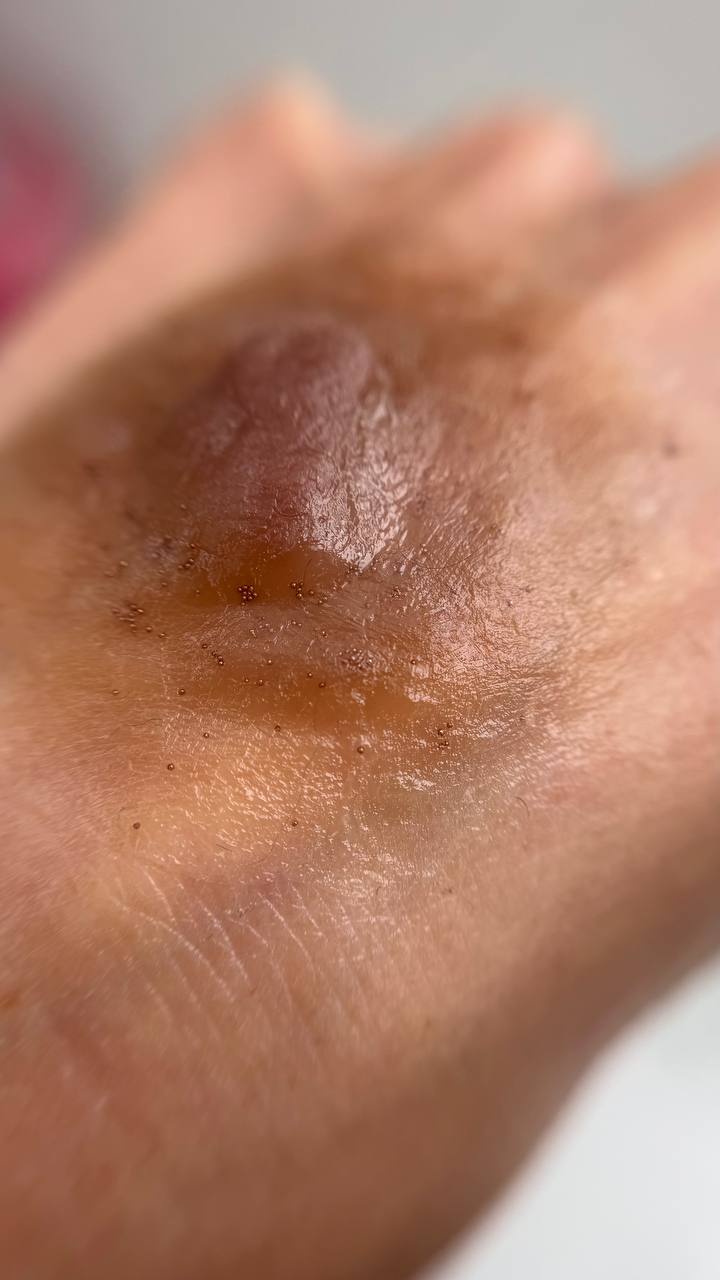 Custom Made Nipple & Areola Prosthetics. Cosmetic and Medical Tattoo by Dasha. Permanent makeup and reconstructive tattoo, scalp micro-pigmentation in Christchurch, New Zealand