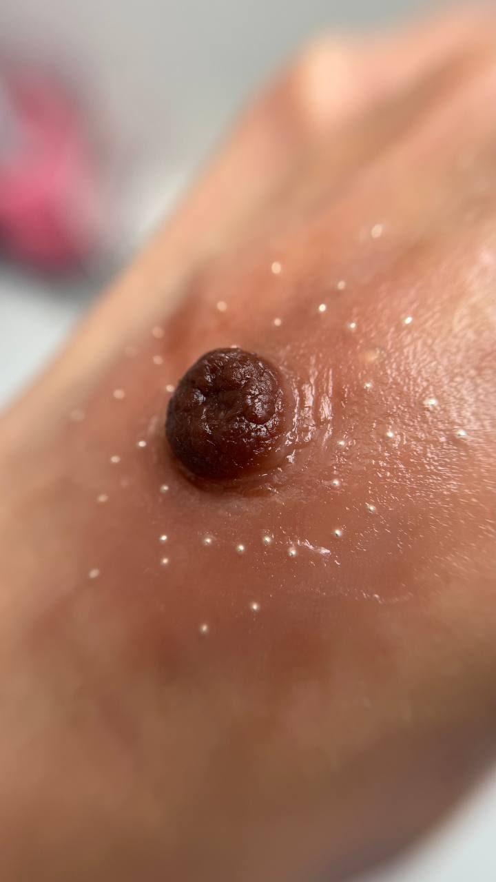 Custom Made Nipple & Areola Prosthetics. Cosmetic and Medical Tattoo by Dasha. Permanent makeup and reconstructive tattoo, scalp micro-pigmentation in Christchurch, New Zealand