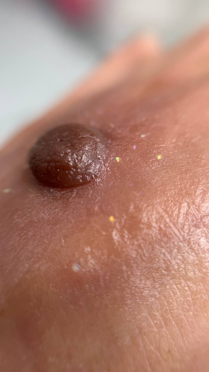 Custom Made Nipple & Areola Prosthetics. Cosmetic and Medical Tattoo by Dasha. Permanent makeup and reconstructive tattoo, scalp micro-pigmentation in Christchurch, New Zealand